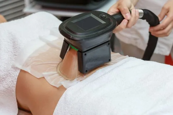 Image of person having fat freezing treatment to help weight gain Oakham