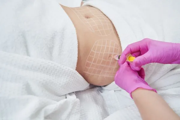 image of fat dissolving injections on love handles to help combat weight gain Oakham