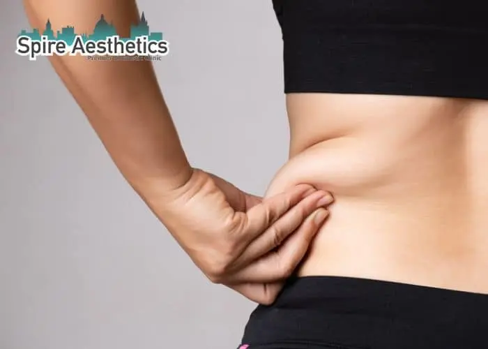 Image of woman pinching fat on their hips Oakham. Fat Freezing treatment