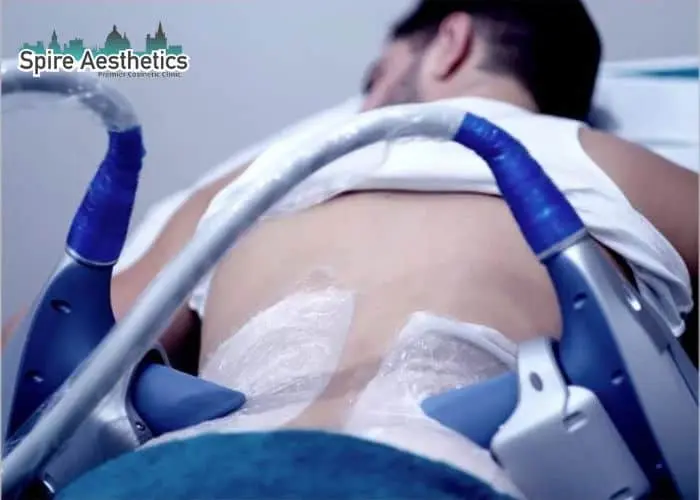 Man having fat freezing treatment done on love handles before a competitions Oakham to create a sculpted look.