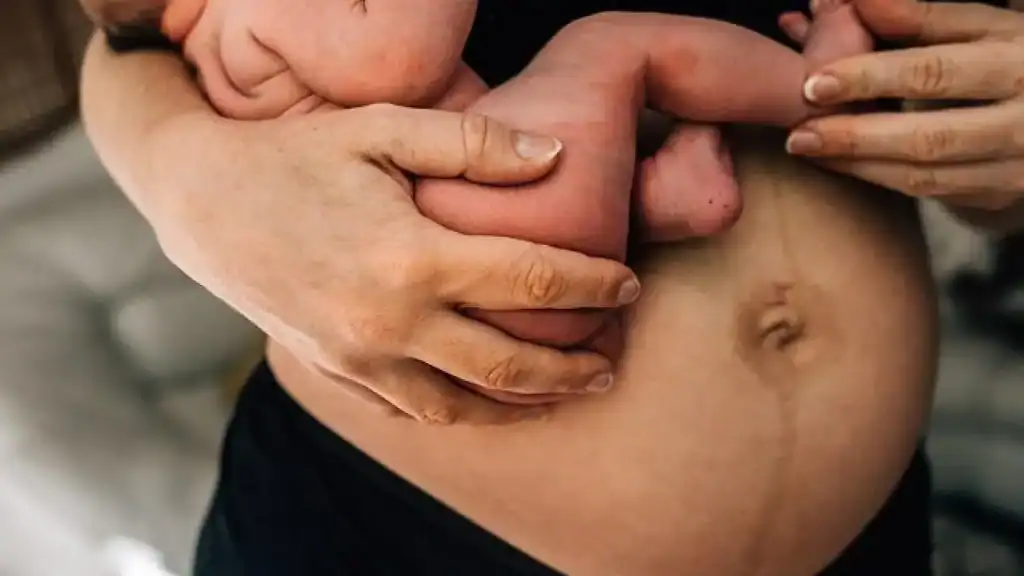 Why Is My Stomach Still Big After Pregnancy Oakham?